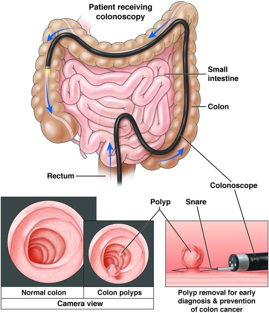 Why Can’t You Wear Makeup During A Colonoscopy ?