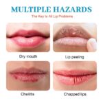 How Do You Stop Dry Lips ?