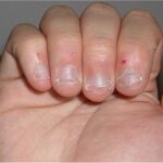 How To Stop Biting Nails ?