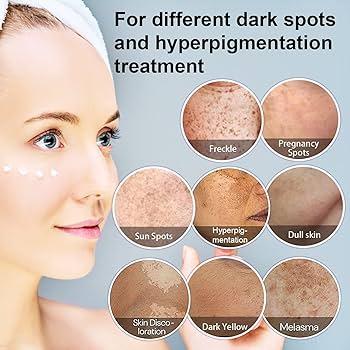 How To Cover Dark Spots With Makeup ?  How To Cover Dark Spots With Makeup ?