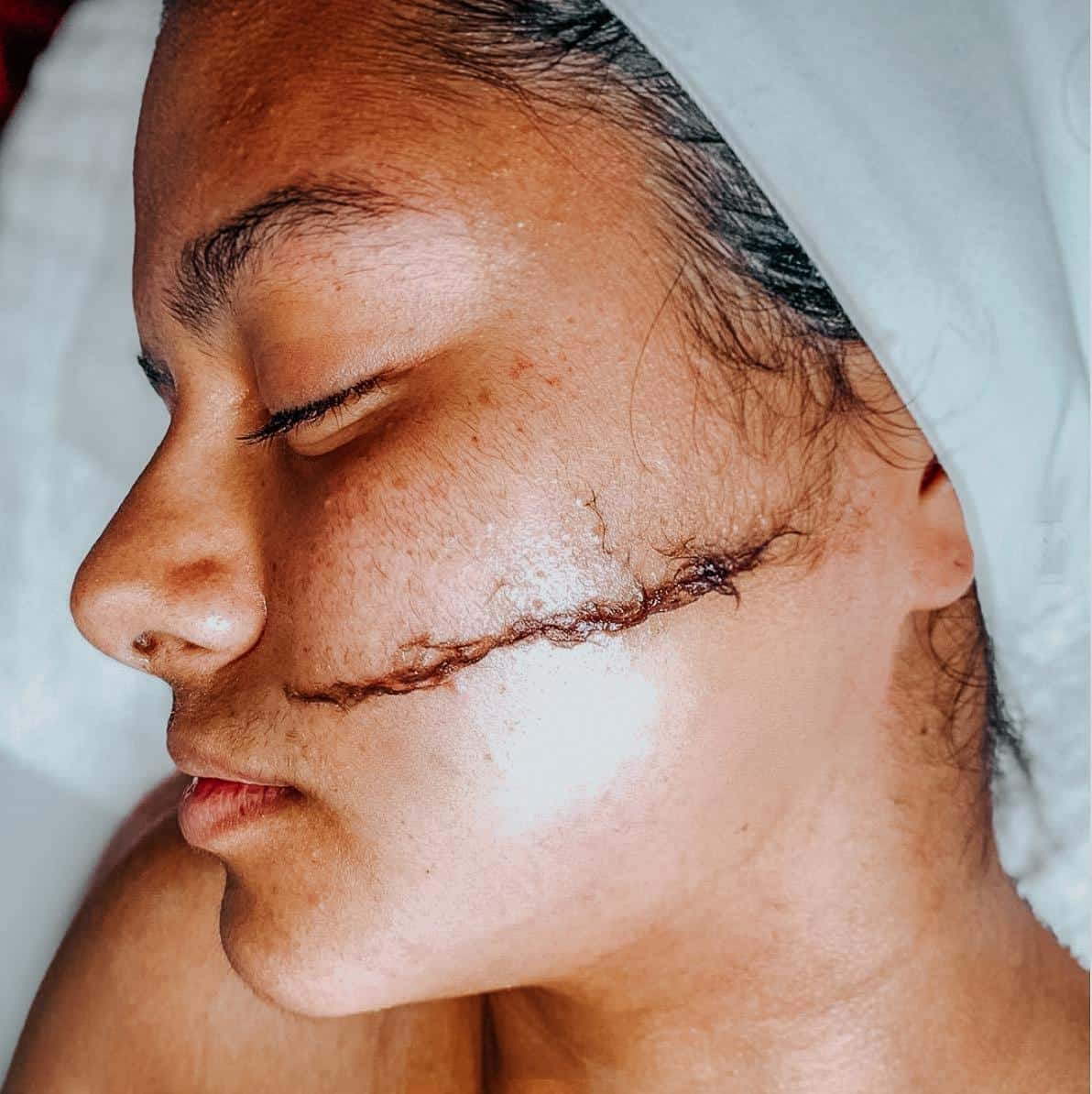 Can You Wear Makeup After Dermaplaning ? Can You Wear Makeup After Dermaplaning ? Can You Wear Makeup After Dermaplaning ? Can You Wear Makeup After Dermaplaning ?