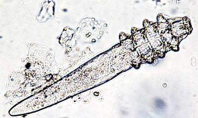 Can Demodex Mites Get Into Makeup ? Can Demodex Mites Get Into Makeup ? Can Demodex Mites Get Into Makeup ? Can Demodex Mites Get Into Makeup ?