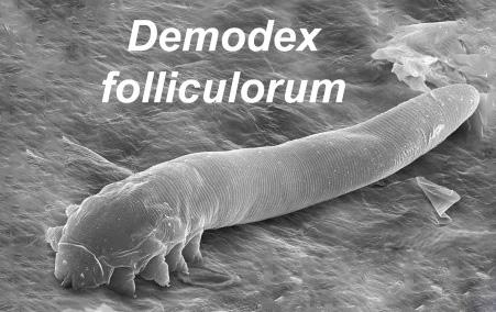 Can Demodex Mites Get Into Makeup ?
