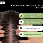 How I Reversed My Pcos Hair Loss Naturally ?
