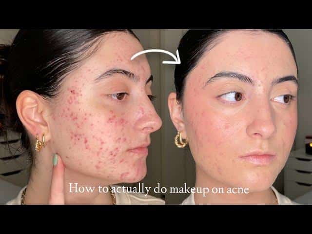 Can Makeup Make You Break Out ? - My Glow Journey