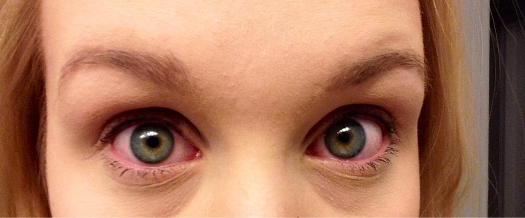 Why Does Mascara Burn My Eyes ? Why Does Mascara Burn My Eyes ?