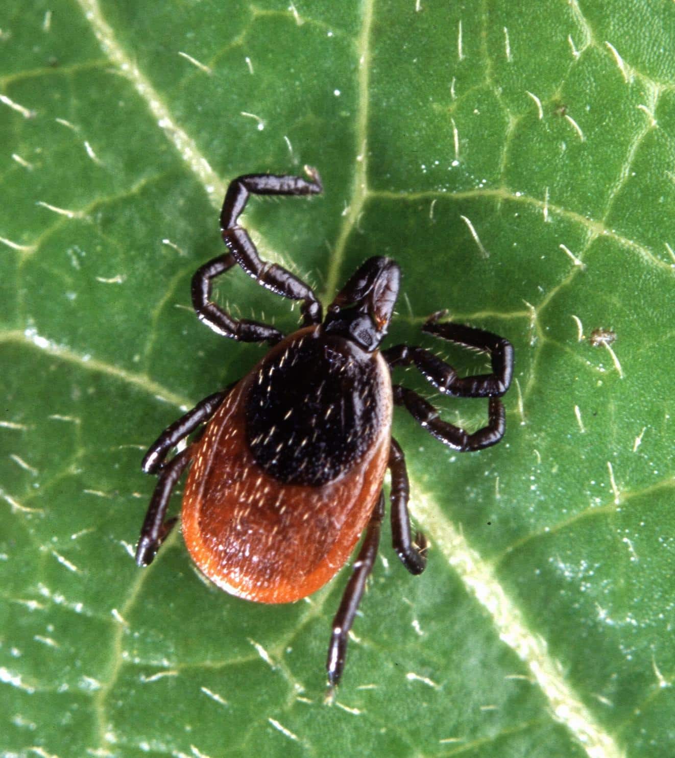 Can Lyme Disease Cause Hair Loss ? Can Lyme Disease Cause Hair Loss ?
