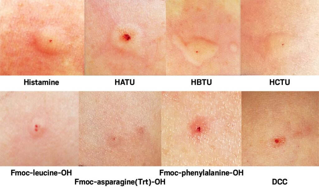 How To Treat Allergic Reaction To Skin Care Product ?