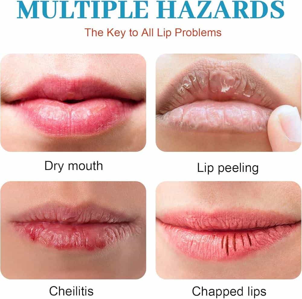 How To Repair Dry Lips Fast ?  How To Repair Dry Lips Fast ?