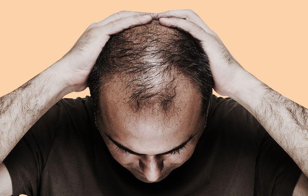 Can Poor Diet Cause Hair Loss ? Can Poor Diet Cause Hair Loss ?