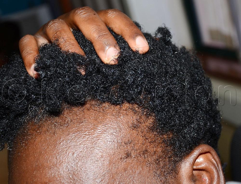 How To Fix Stunted Hair Growth ? How To Fix Stunted Hair Growth ?