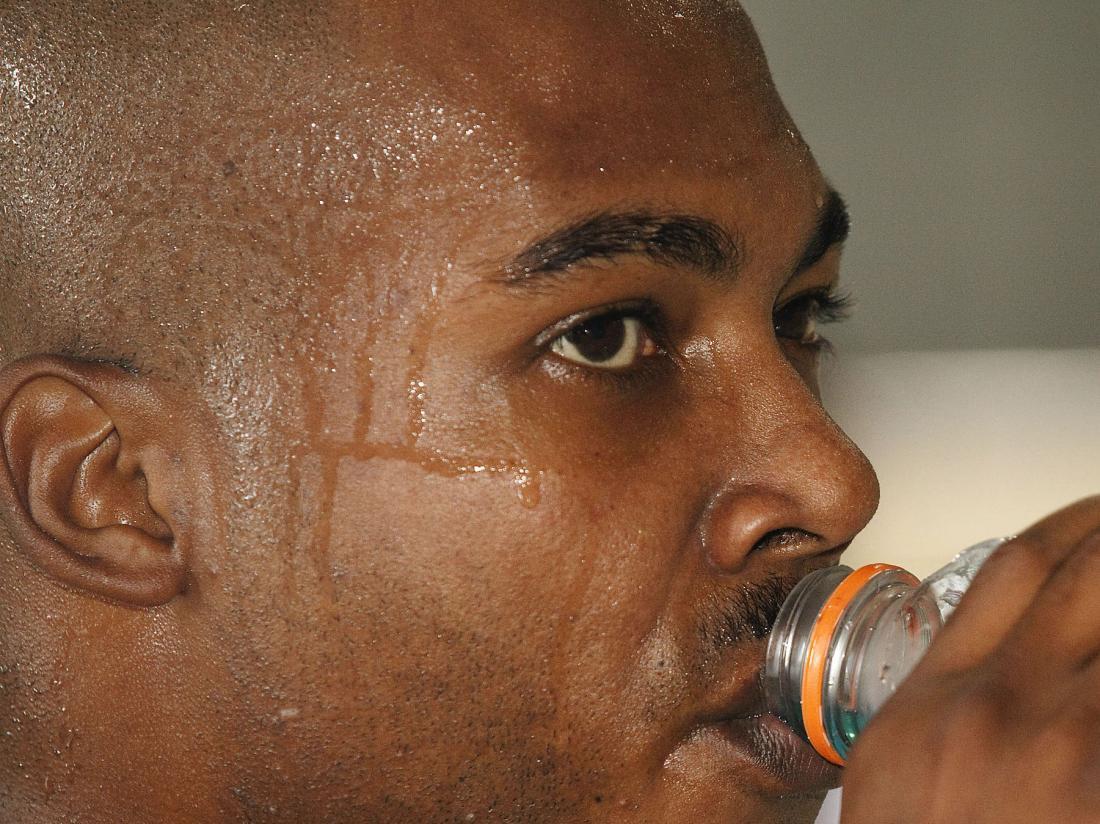 Does Sweating Cause Hair Loss ? Does Sweating Cause Hair Loss ?