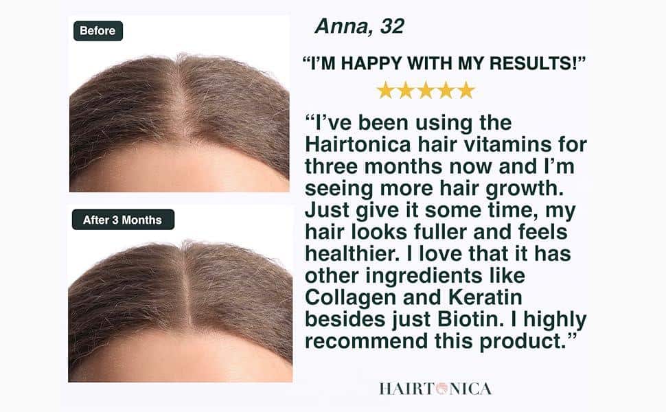 Will Msm Help Hair Growth ? Will Msm Help Hair Growth ?
