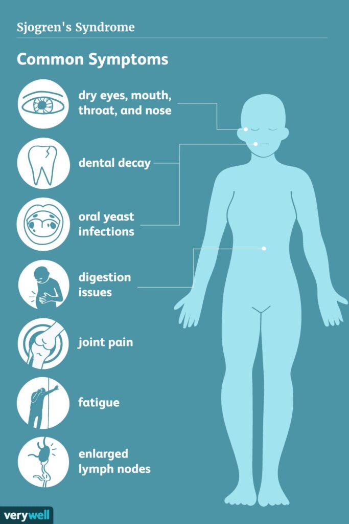 Can Sjogren's Cause Hair Loss ? Can Sjogren's Cause Hair Loss ? Can Sjogren's Cause Hair Loss ? Can Sjogren's Cause Hair Loss ?