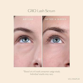 Is Vegamour Hair Serum Good ? Is Vegamour Hair Serum Good ? Is Vegamour Hair Serum Good ? Is Vegamour Hair Serum Good ?