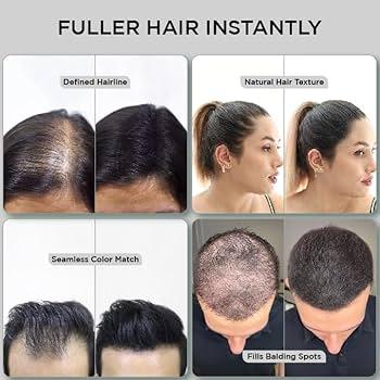 Can Hair Fibers Cause Hair Loss ? Can Hair Fibers Cause Hair Loss ? Can Hair Fibers Cause Hair Loss ? Can Hair Fibers Cause Hair Loss ?