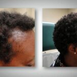 How To Get A Job In Hair Loss Research ?