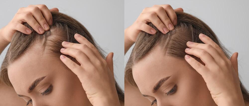 Can Your Hair Grow With Split Ends ?  Can Your Hair Grow With Split Ends ?