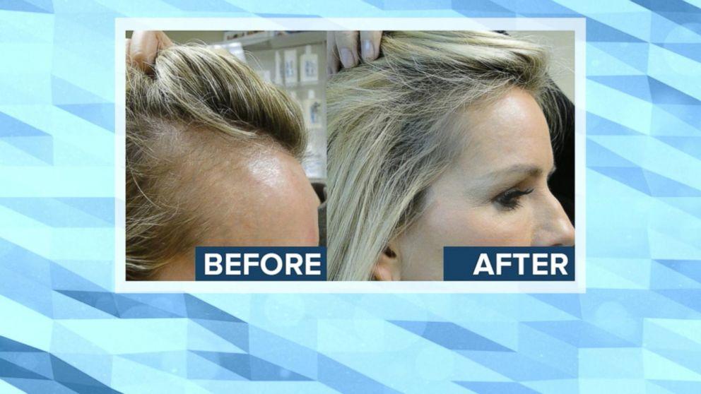 How To Get A Job In Hair Loss Research ? How To Get A Job In Hair Loss Research ? How To Get A Job In Hair Loss Research ? How To Get A Job In Hair Loss Research ?