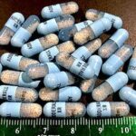Does Adderall Cause Hair Loss ?
