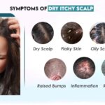 Does Itchy Scalp Mean Hair Growth ?