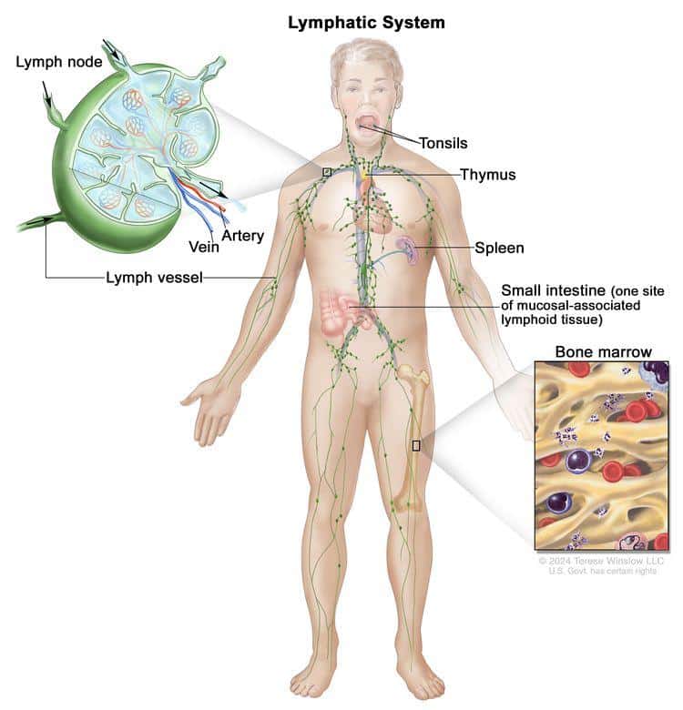 Does Lymphoma Cause Hair Loss ? Does Lymphoma Cause Hair Loss ?