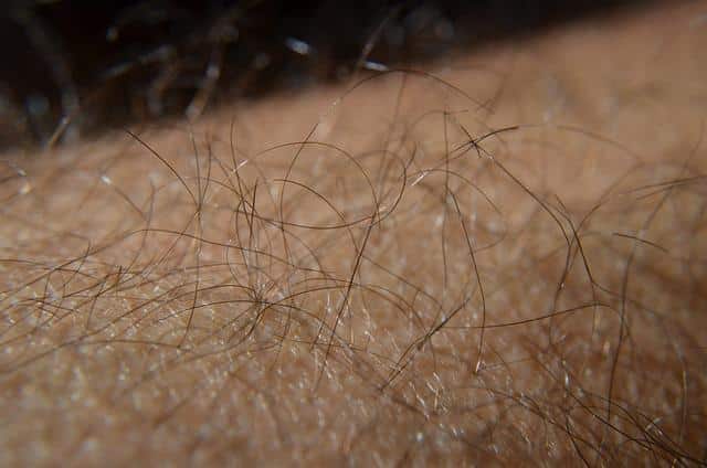 What Are The Reason Of Not Hair Growth Blak Idition ?